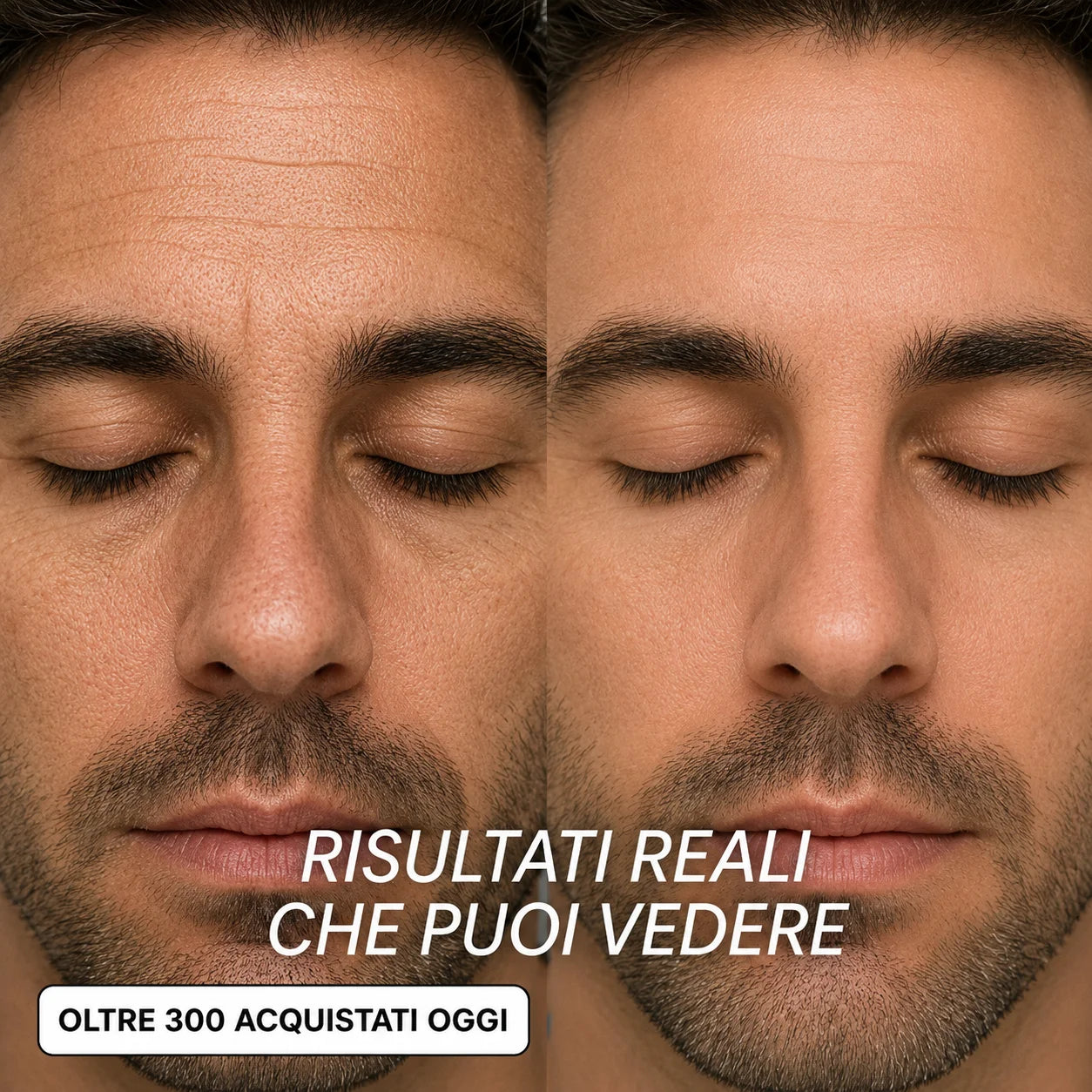 Seralys™ Men's Stick Rimpolpante Bio-Collagene PDRN