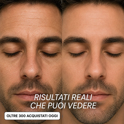 Seralys™ Men's Stick Rimpolpante Bio-Collagene PDRN