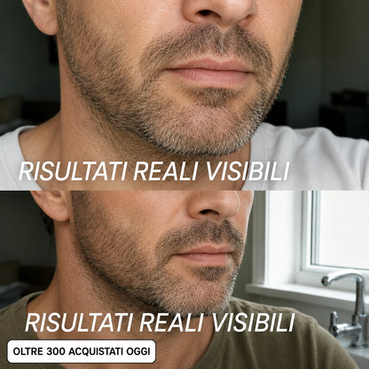 Seralys™ Men's Stick Rimpolpante Bio-Collagene PDRN