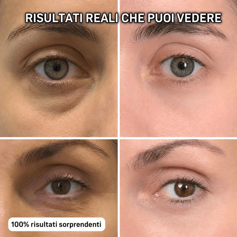 Seralys™ Stick Rimpolpante Bio-Collagene PDRN