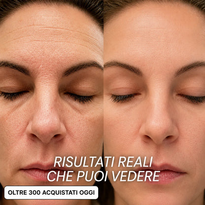 Seralys™ Stick Rimpolpante Bio-Collagene PDRN